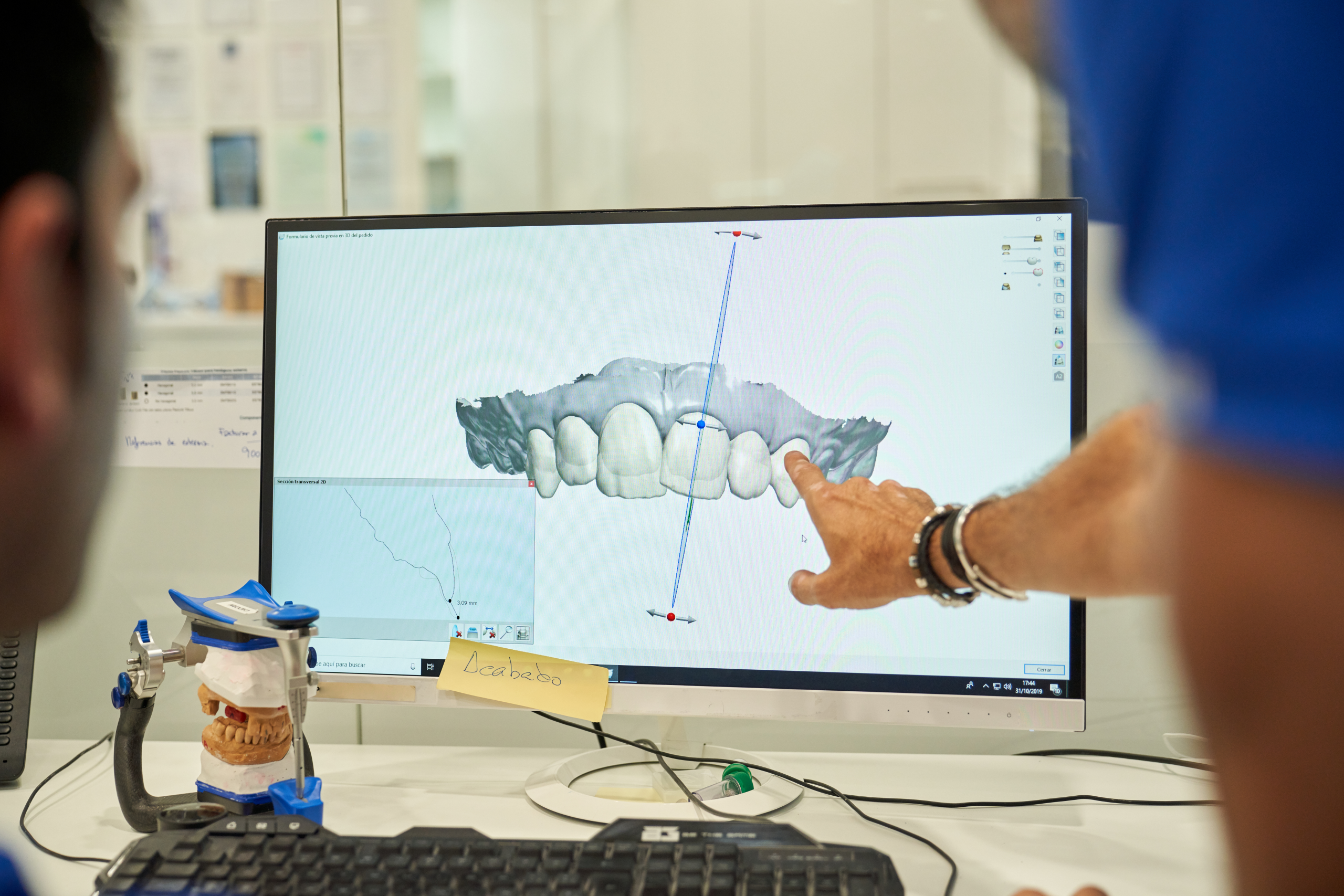 Computergestützte Planung der späteren Implantatversorgung
